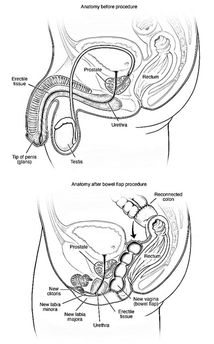 transrodna hirurgija slika 3
